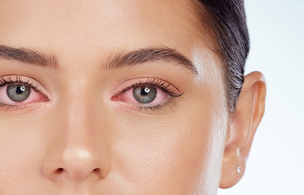 Контактные линзы при конъюнктивите